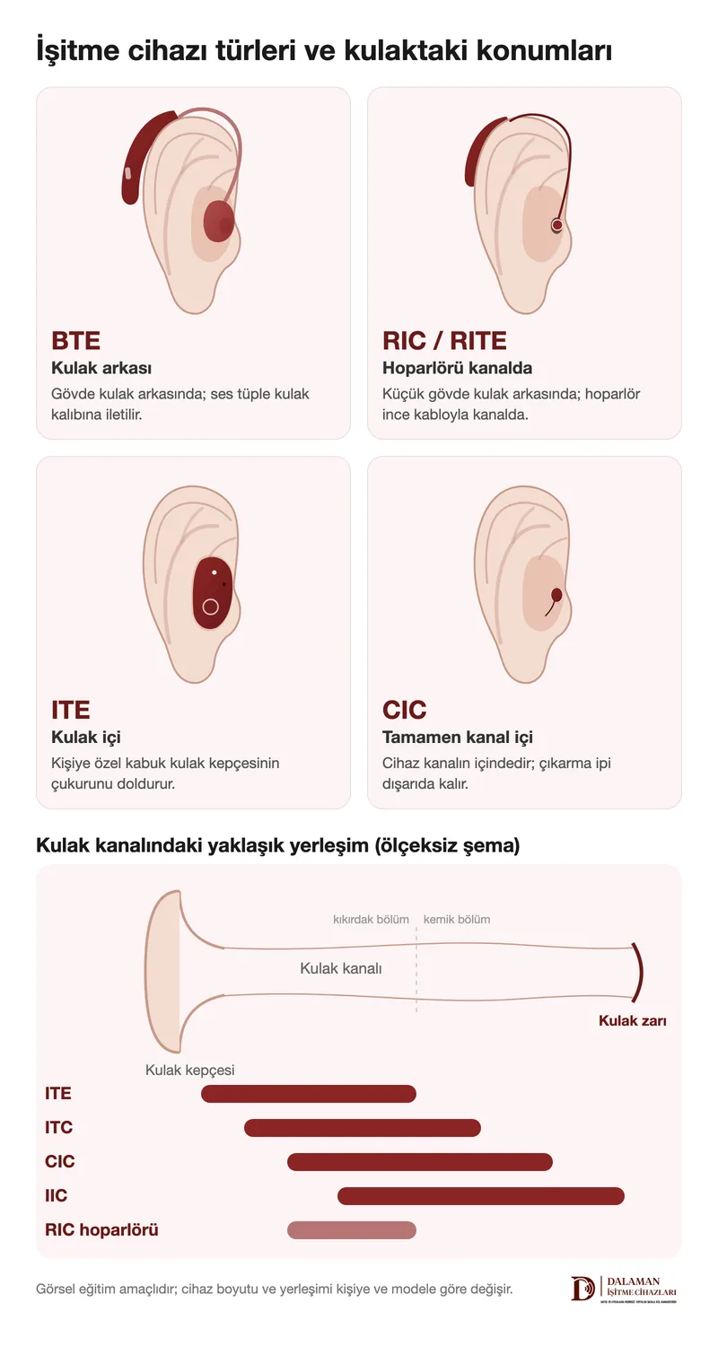 BTE, RIC, ITE ve CIC işitme cihazlarının kulaktaki konumlarını ve kulak kanalındaki yaklaşık yerleşimlerini gösteren şema